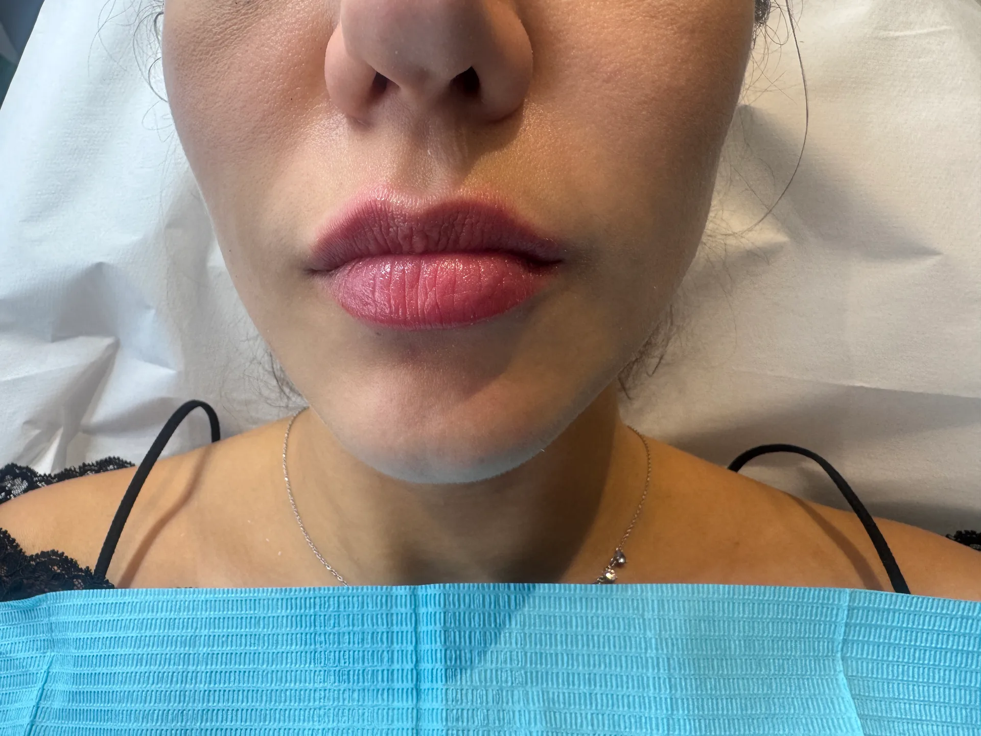 Rimodelimi buzes, rezultat natyral — Foto 2