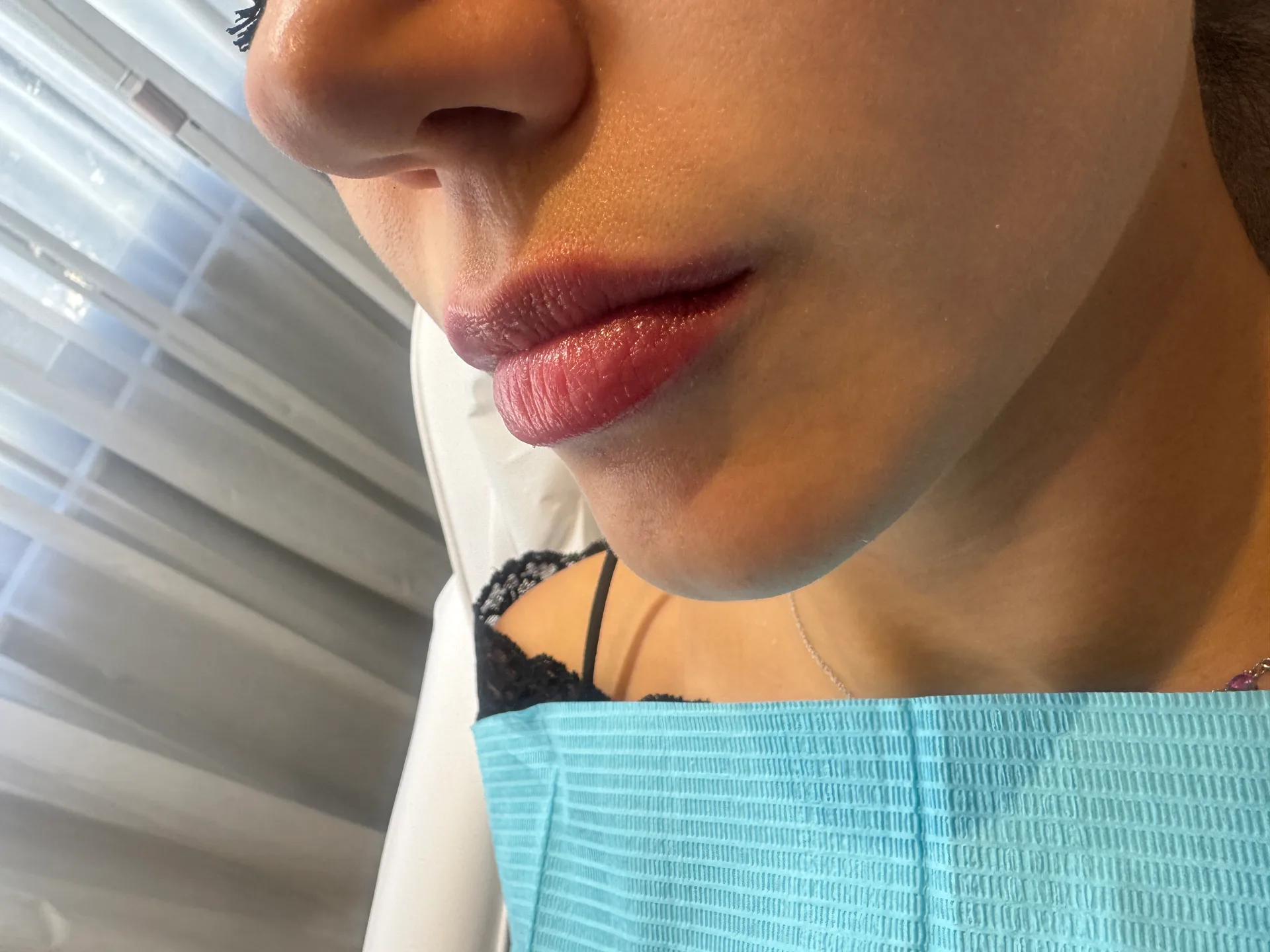 Rimodelimi buzes, rezultat natyral — Foto 3